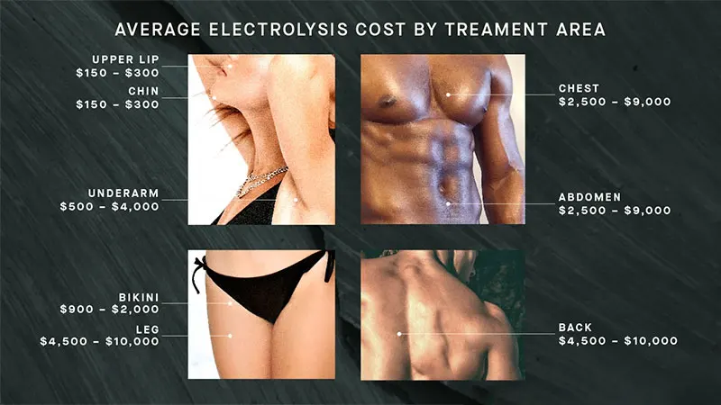 How Much Does Electrolysis Hair Removal Cost
